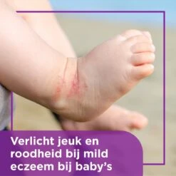 Bepanthen Eczeem Creme - Verlicht Jeuk En Roodheid - Mild Tot Matig Atopisch Eczeem - Ook Bij Babies - 20 Gram -Aanbiedingen BIBS Winkel 1200x1200 1657