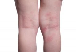 Donttellmum - Eczeem Repair Creme - 50 Ml 20 Donttellmum - Eczeem Repair Creme - 50 Ml -Aanbiedingen BIBS Winkel 1200x818 1