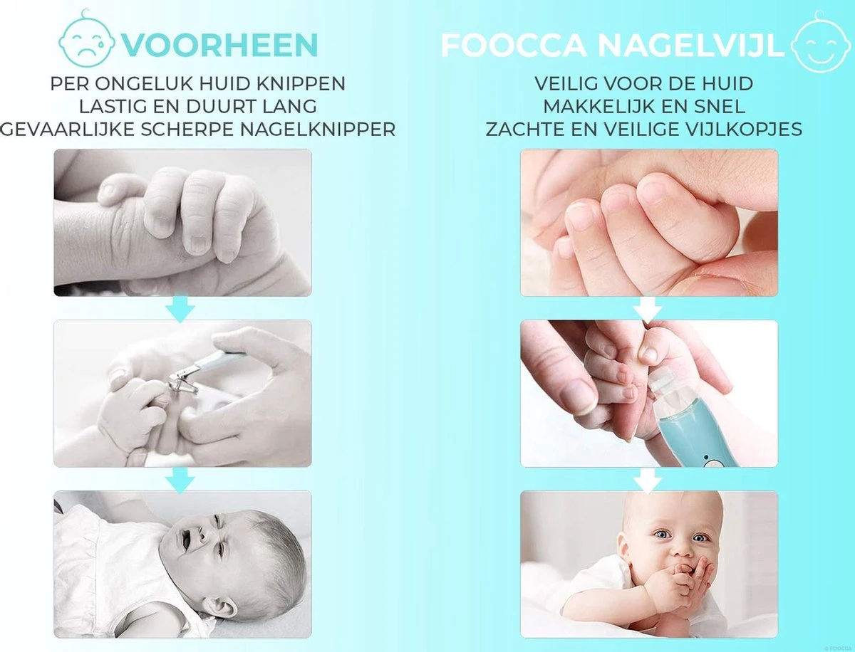 FOOCCA Baby Nagelknipper - Oplaadbaar - Baby Manicureset - Baby Verzorgingsset - Baby Nagelvijl - Baby Nagelschaartje - Baby Nagelset - Elektrisch. 4 FOOCCA Baby Nagelknipper - Oplaadbaar - Baby Manicureset - Baby Verzorgingsset - Baby Nagelvijl - Baby Nagelschaartje - Baby Nagelset - Elektrisch. - Afbeelding 4